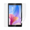 IGET Blackview TAB G5 fólia na celé telo - Fólia na celé telo