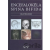 Encefalokéla spina bifida - František Horn