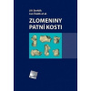 Zlomeniny patní kosti - Stehlík Jiří, Jan Štulík et al.