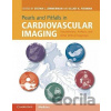 Pearls and Pitfalls in Cardiovascular Imaging - Cambridge University Press