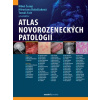 Atlas novorozeneckých patologií - Miroslava Balaščaková; Miloš Černý; Tomáš Fait