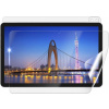 Screenshield IGET Smart L11 2K fólie na celé tělo IGT-SML112K-B