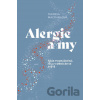 Alergie a my - Theresa MacPhail