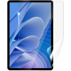 Screenshield DOOGEE T30 PRO LTE fólia na displej DOO-T30PR-D