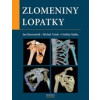 Zlomeniny lopatky - Bartoníček Jan Tuček Michal Naňka Ondřej