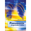 Pneumonie diagnostika a léčba - Kolek Vítězslav