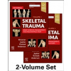 Skeletal Trauma