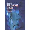 Jde o vaše kosti - Jean-Claude Alix