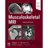 Musculoskeletal MRI - Nancy M. Major, Mark W. Anderson