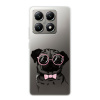 Silikonové pouzdro iSaprio - Xiaomi 14T - The Pug (Odolný silikonový kryt, obal, pouzdro iSaprio - Xiaomi 14T - The Pug - skvělá ochrana a pružnost, stylový UV potisk, lehkost, tiskne se v České repub