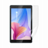 Screenshield IGET Blackview TAB G5 fólia na displej IGT-BVTABG5-D