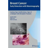 Casting-Type Calcifications: Sign of a Subtype with Deceptive Features