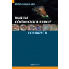 Manuál oční mikrochirurgie v obrazech