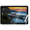 Screenshield IGET Smart W30 fólia na celé telo IGT-SMW30-B