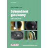 Sekundární glaukomy - Vybrané kapitoly - 2.vydání - Klára A. Samková