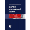Biopsie sentinelové uzliny