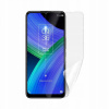 Ochranná fólia Screenshield TCL 20R 5G - displej