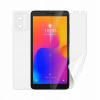 Ochranná fólia Screenshield Alcatel 1B 2022 (5031G) - celé tělo