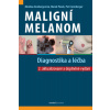 Maligní melanom (Marek Pásek, Monika Arenbergerová, Petr Arenberger)