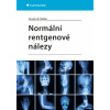 Normální rentgenové nálezy