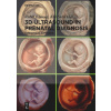 3D Ultrasound in Prenatal Diagnosis (Kai-Sven Heling)()