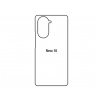 Ochranná fólia Sunshine Hydrogel pre Huawei Nova 10 Variant:: zadná čirá