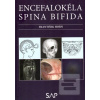 Encefalokéla spina bifid… (František Horn)