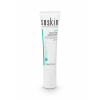 Soskin akn stop imperfection serum na zapálené akne lokality 15 ml.