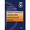 Projevy vzácných onemocnění v orofaciální oblasti