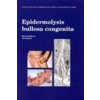 Epidermolysis bullosa congenita (Hana Bučková, Jan Buček, Jan Buček)