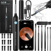 SMART OTOSKOP KAMERA NA ČISTENIE UŠÍ ODSTRÁNENIE UŠNÉHO MAZU WIFI HD ENDOSKOP