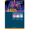 ARDS v klinické praxi - Jan Máca