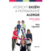 Atopický ekzém a potravinové alergie očima mámy - Jana Ligurská