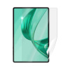 Screenshield HUAWEI Honor Pad X8a fólia na displej (HUA-HONPX8A-D)