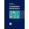 Zlomeniny patní kosti